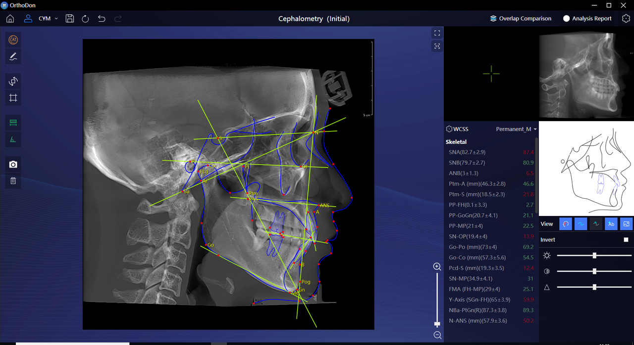 Automatic cephalometric landmark detection