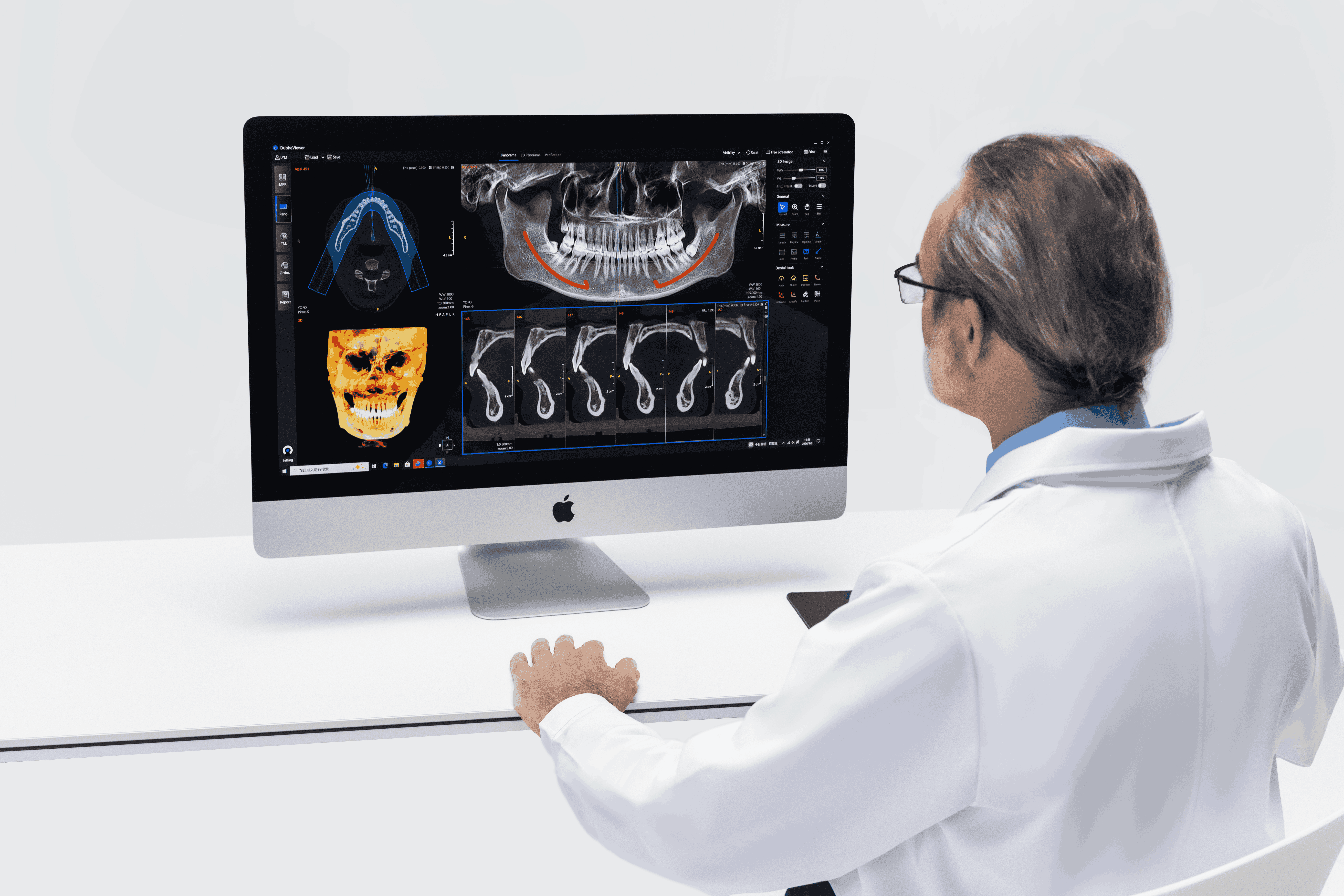 Clinician using the YOFO MPR workspace