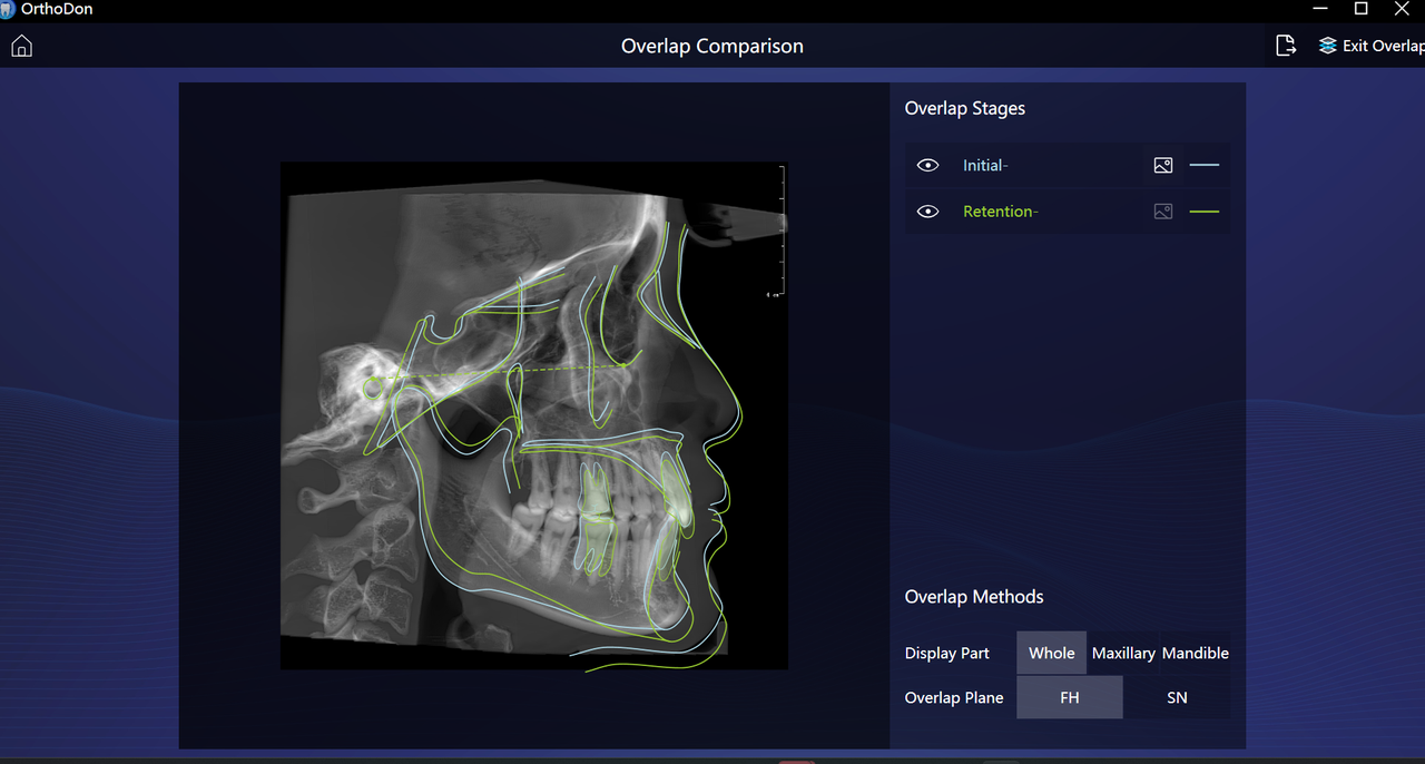 Orthodontic treatment superimposition