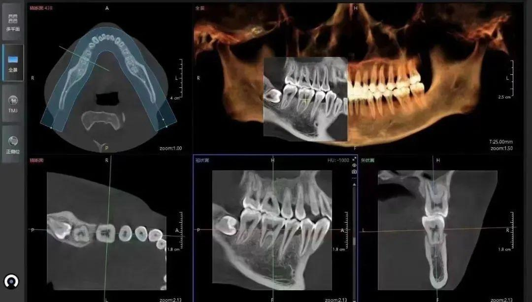 Dental CBCT imaging software