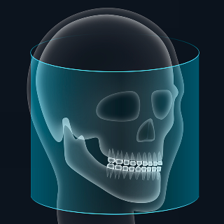 FOV 20 x 18 image 1