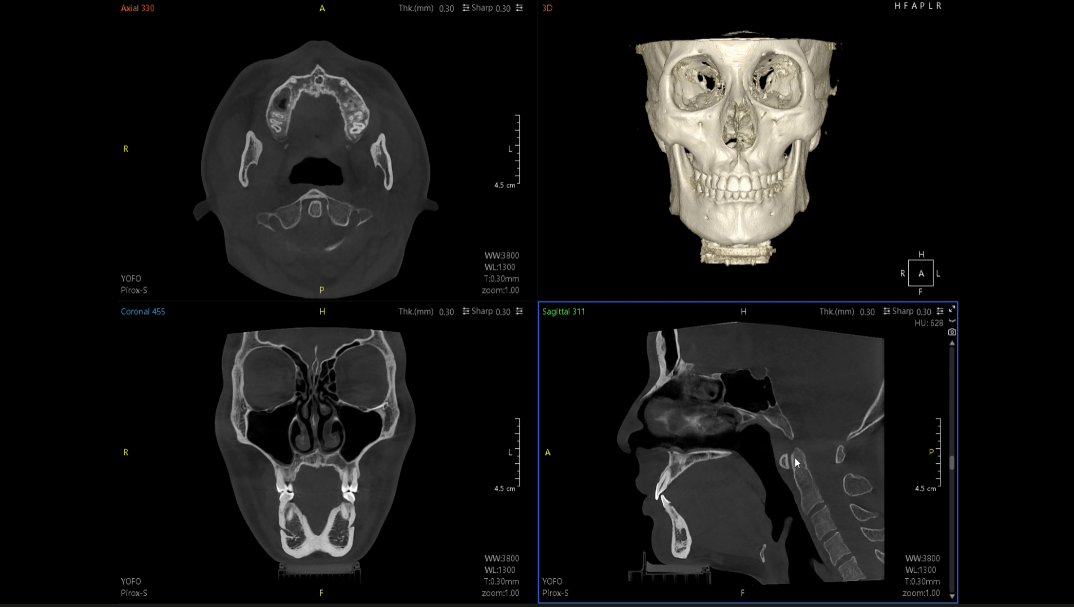 Clinical scan interface examples