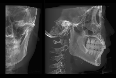 Patented unilateral cephalometric imaging