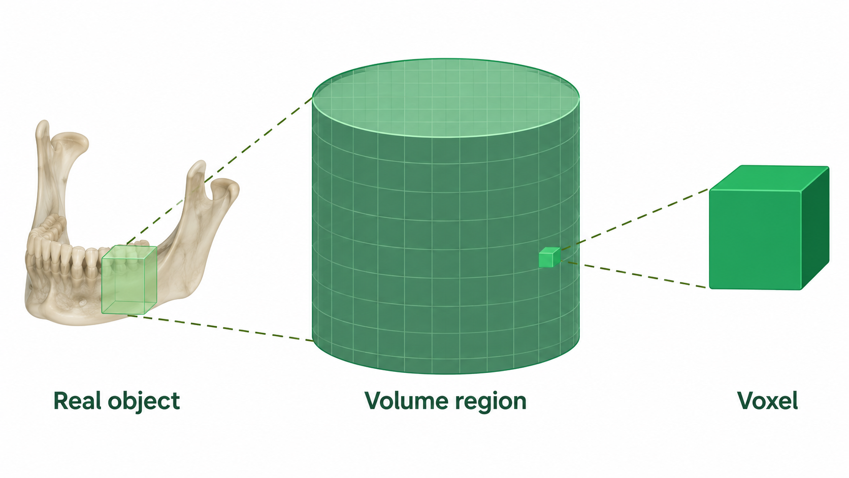 Diagram showing a dental CBCT scan from a real mandibular object to the volume region and an individual voxel.